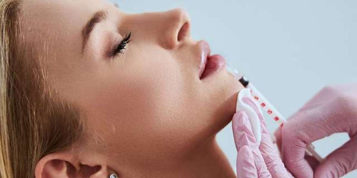 Achieve Youthful Radiance with Fillers at Lifestyle's MedSpa in Culpeper