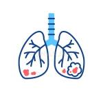 LungCancerTreatment Bangalore Profile Picture