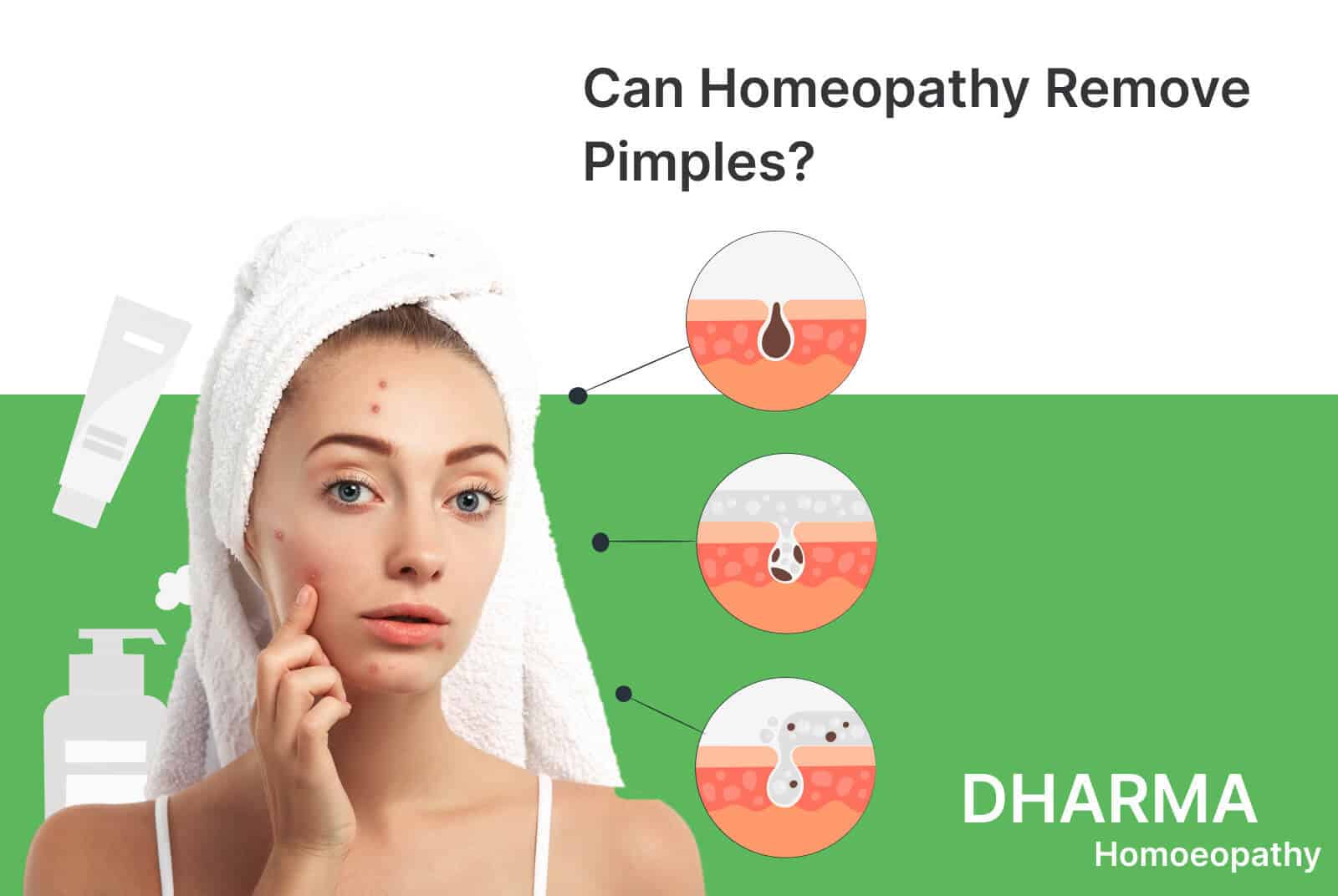 Can Homeopathy Remove Pimples?